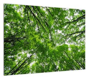 Obraz - Widok do korony drzewa (70x50 cm)